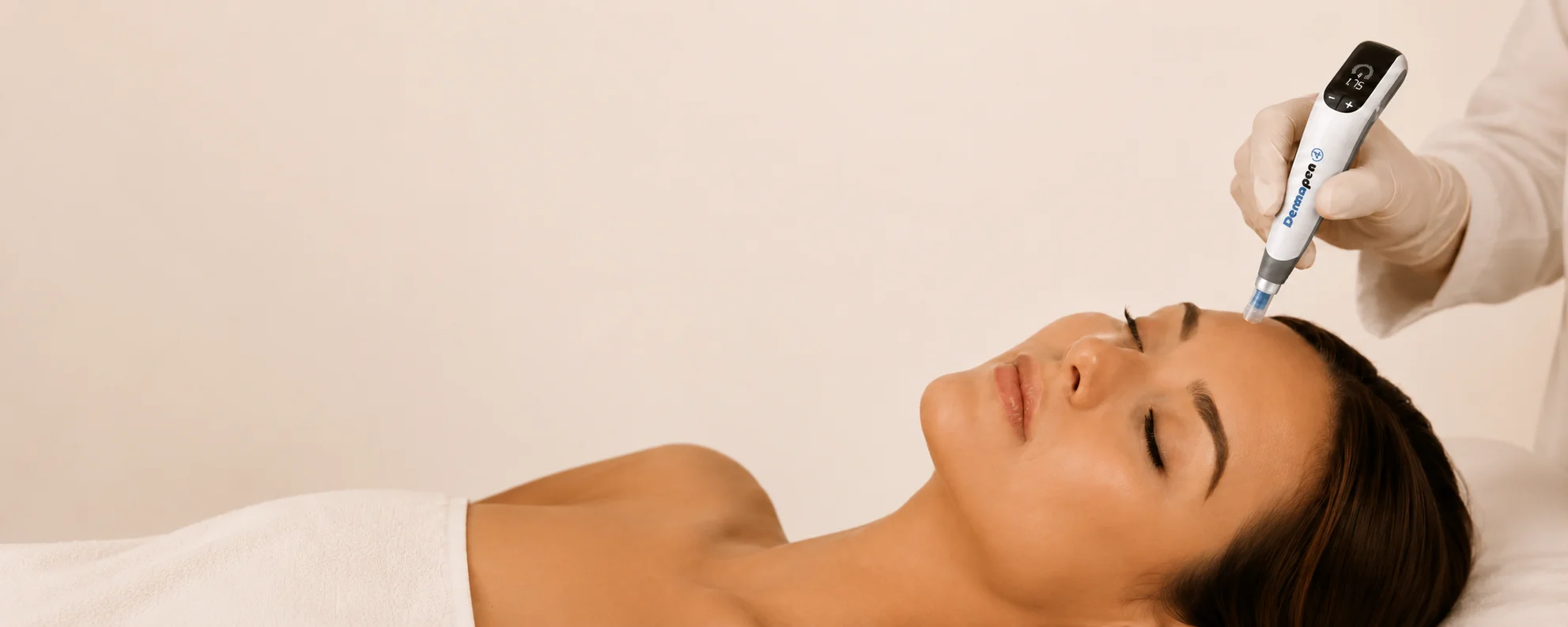 Microneedling vampire facial treatment at YYC Medical Aesthetics Calgary